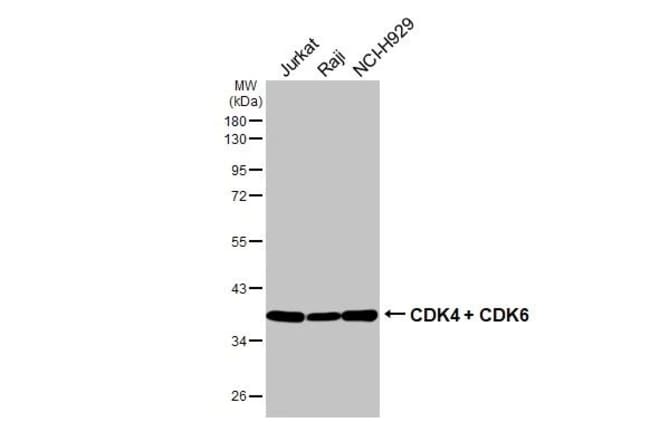 100UL CDK4/CDK6 RMAB 100 UL