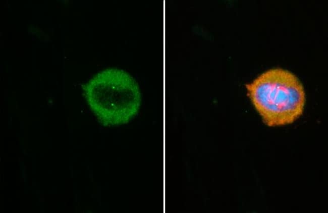 100UL CEP152 RMAB 100 UL