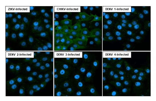 100UL CHIKUNGUNYA VIRUS NSP1 (S RMAB 100