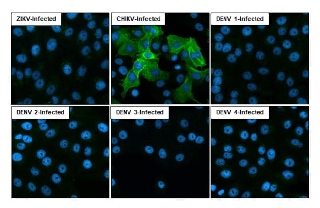 100UL CHIKUNGUNYA VIRUS NSP1 (S RMAB 100