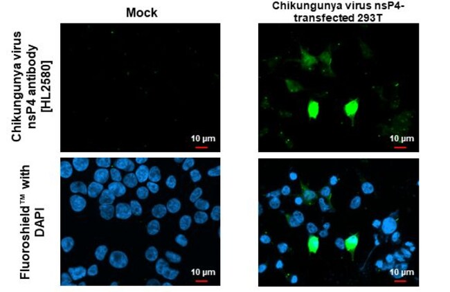 100UL CHIKUNGUNYA VIRUS NSP4 (S RMAB 100