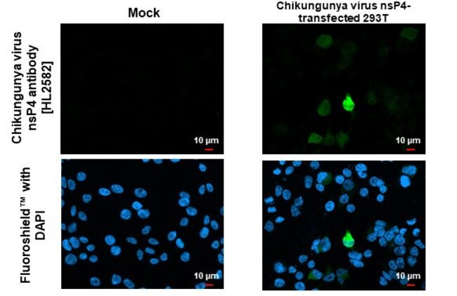 100UL CHIKUNGUNYA VIRUS NSP4 (S RMAB 100