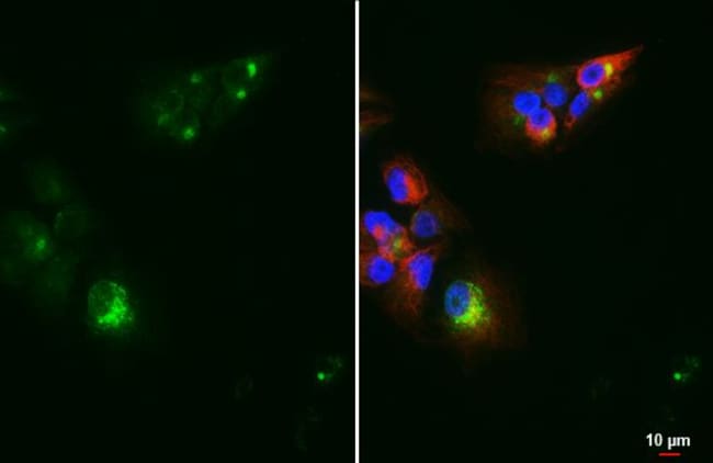 100UL CHROMOGRANIN C RMAB 100 UL