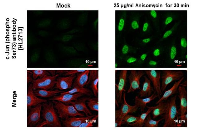 100UL PHOSPHO-C-JUN (SER73) RMAB 100 UL