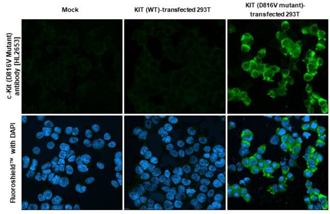 100UL C-KIT (D816V MUTANT) RMAB 100 UL