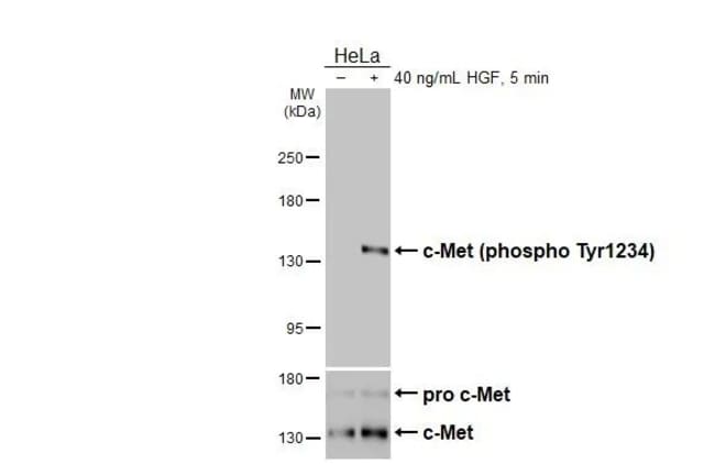 100UL PHOSPHO-C-MET (TYR1234) RMAB 100 U