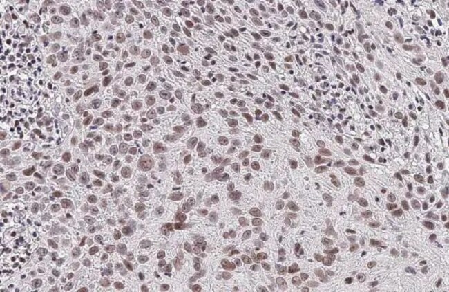 100UL PHOSPHO-CREB (SER133) RMAB 100 UL