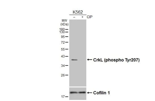 100UL PHOSPHO-CRKL (TYR207) RMAB 100 UL