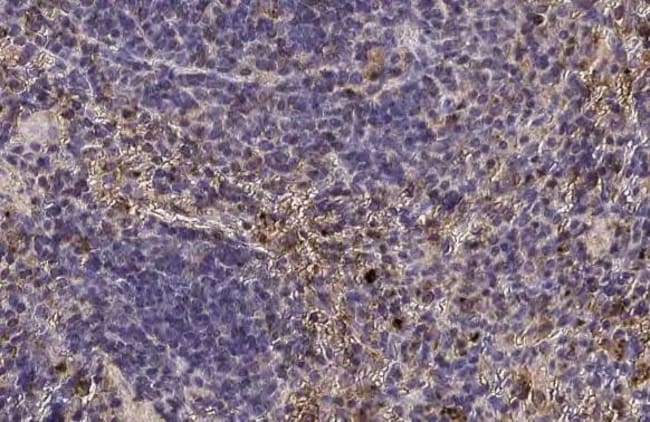 100UL CTLA-4 RMAB 100 UL