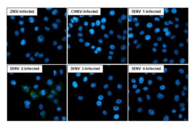 100UL DENGUE VIRUS TYPE 2/4 CAP RMAB 100