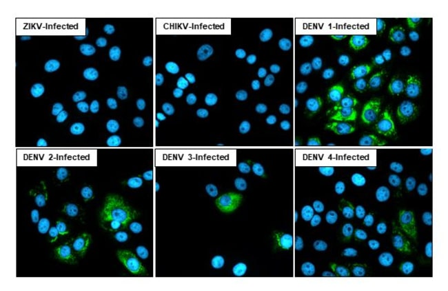 100UL DENGUE VIRUS TYPE 1-4 NS1 RMAB 100