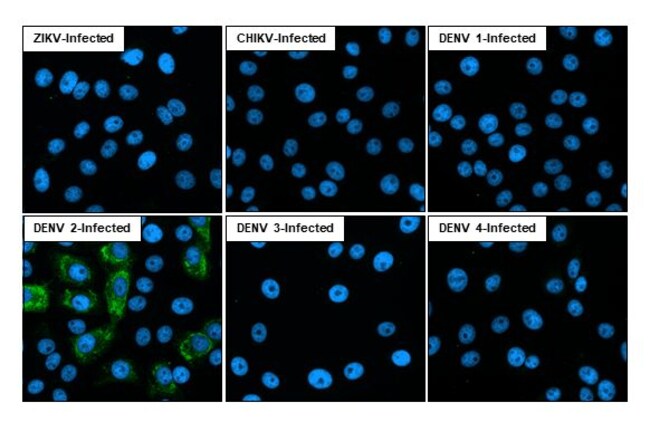 100UL DENGUE VIRUS TYPE 2/4 NS2 RMAB 100