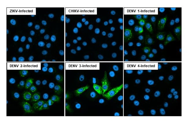100UL DENGUE VIRUS TYPE 1-4 NS2 RMAB 100