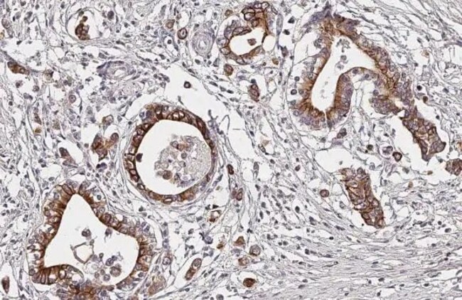 100UL D4 DOPAMINE RECEPTOR RMAB 100 UL