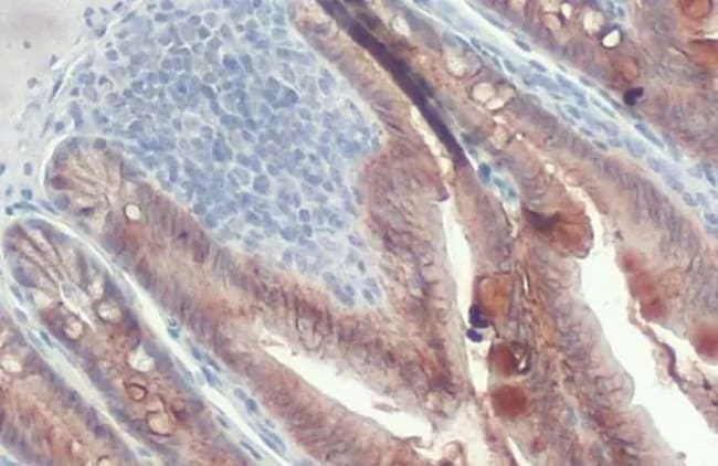 100UL E-CADHERIN RMAB 100 UL