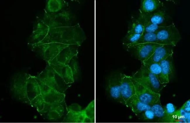 100UL E-CADHERIN RMAB 100 UL