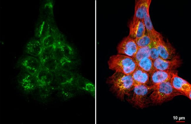 100UL FIBULIN 3 RMAB 100 UL