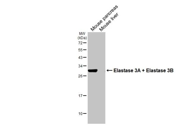100UL ELASTASE 3A/3B RMAB 100 UL