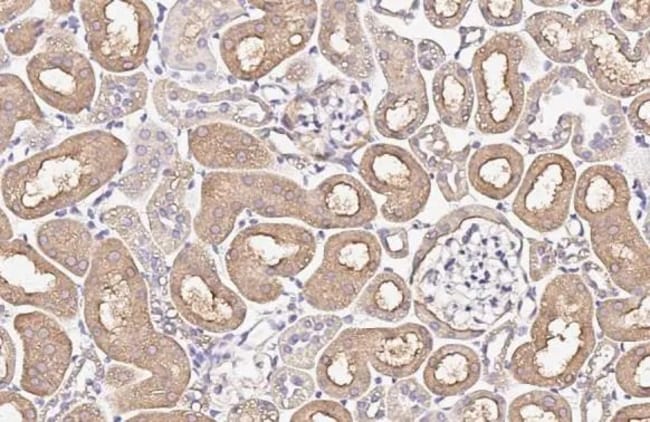 100UL ALPHA-ENAC RMAB 100 UL