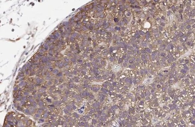 100UL ENDOTHELIN B RECEPTOR RMAB 100 UL