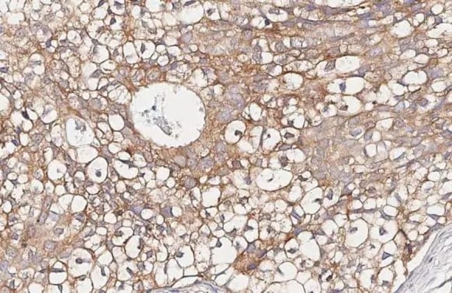 100UL ENDOTHELIN B RECEPTOR RMAB 100 UL