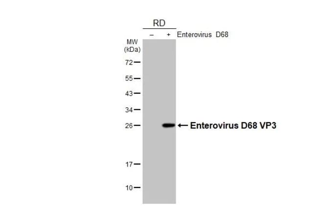 100UL ENTEROVIRUS D68 VP3 (STRA RMAB 100