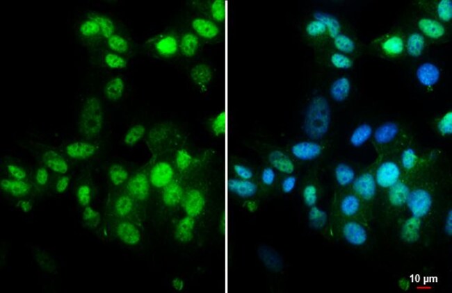 100UL ESTROGEN RECEPTOR ALPHA RMAB 100 U