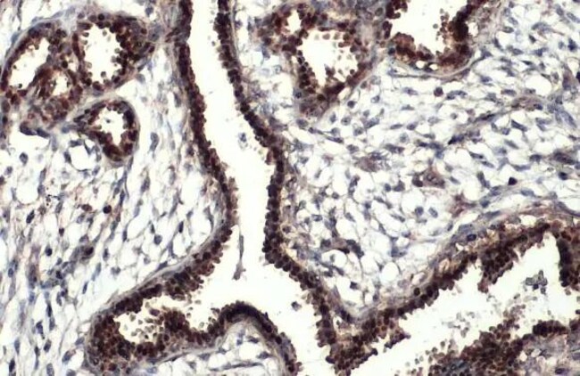 100UL ESTROGEN RECEPTOR ALPHA RMAB 100 U