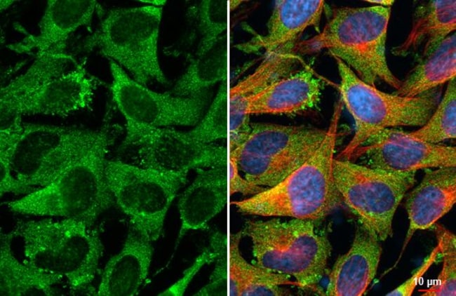 100UL FIBRONECTIN RMAB 100 UL