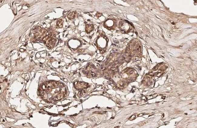 100UL PHOSPHO-FOXO1 (SER256) RMAB 100 UL