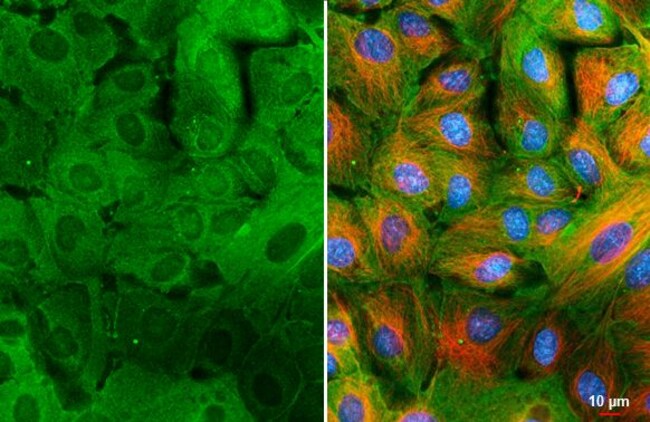 100UL GALECTIN 3 RMAB 100 UL
