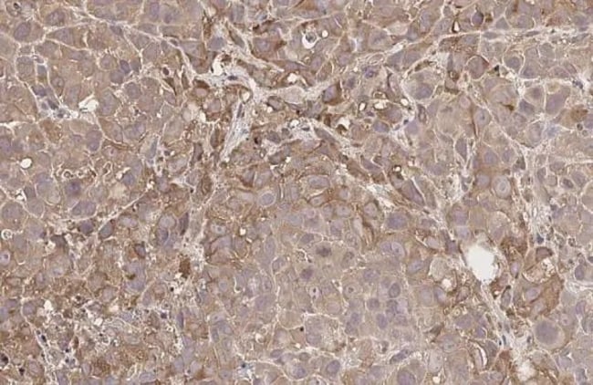 100UL GNRHR RMAB 100 UL