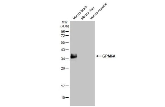 100UL GPM6A RMAB 100 UL