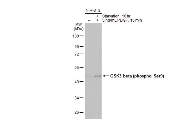 100UL PHOSPHO-GSK3B (SER9) RMAB 100 UL