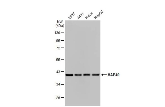 100UL HAP40 RMAB 100 UL