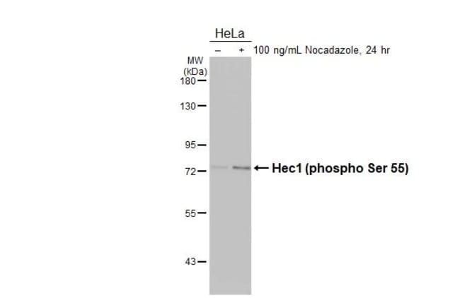 100UL PHOSPHO-HEC1 (SER55) RMAB 100 UL