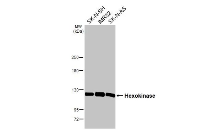 100UL HEXOKINASE RMAB 100 UL