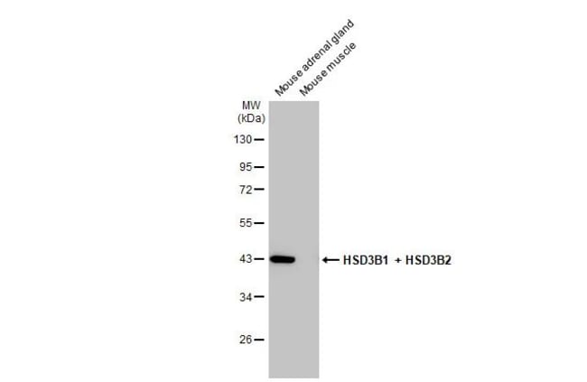 100UL HSD3B1/HSD3B2 RMAB 100 UL