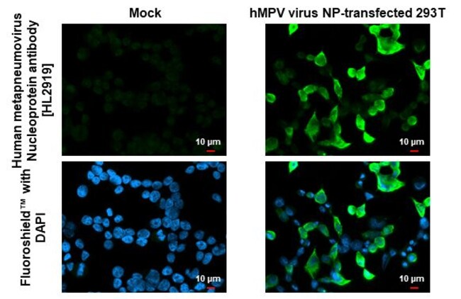 100UL METAPNEUMOVIRUS NUCLEOPRO RMAB 100