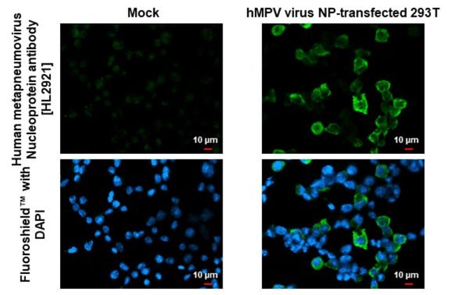 100UL METAPNEUMOVIRUS NUCLEOPRO RMAB 100