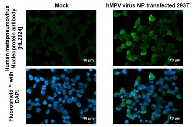 100UL METAPNEUMOVIRUS NUCLEOPRO RMAB 100