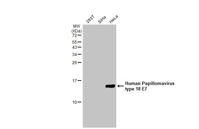 100UL HPV TYPE 18 E7 RMAB 100 UL