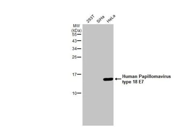 100UL HPV TYPE 18 E7 RMAB 100 UL
