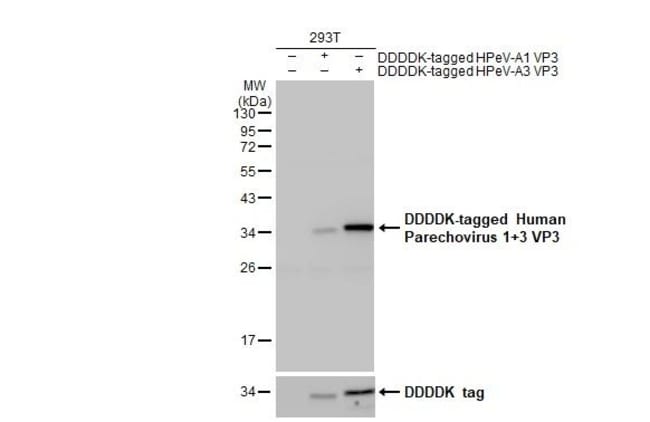 100UL HUMAN PARECHOVIRUS 1/3 VP RMAB 100