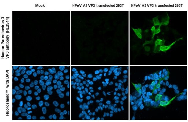 100UL HUMAN PARECHOVIRUS 3 VP3 RMAB 100