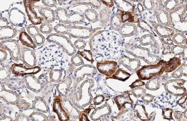 100UL IGF2 RMAB 100 UL