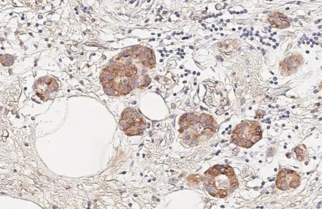 100UL INSR BETA RMAB 100 UL