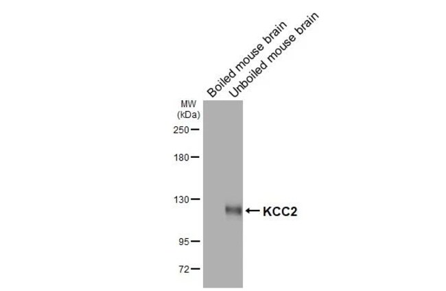 100UL KCC2 RMAB 100 UL