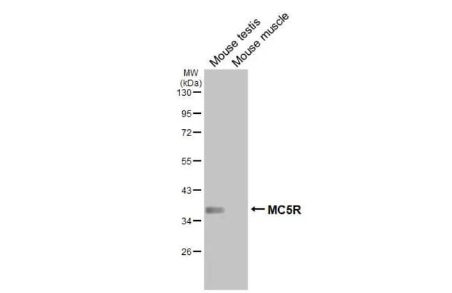 100UL MC5R RMAB 100 UL