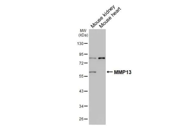 100UL MMP13 RMAB 100 UL